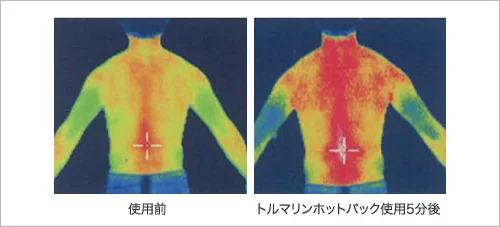 トルマリンホットパックを使用した5分後のサーモグラフィ画像